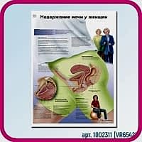 Плакат медицинский НЕДЕРЖАНИЕ МОЧИ У ЖЕНЩИН 